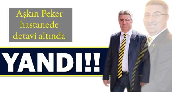 YANMA TEHLİKESİ GEÇİRDİ