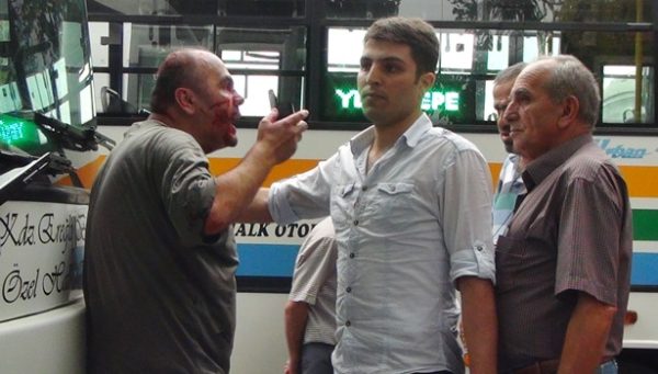BIÇAKLI VE SOPALI SALDIRI..!