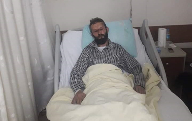 KAFASI İKİYE YARILDI…