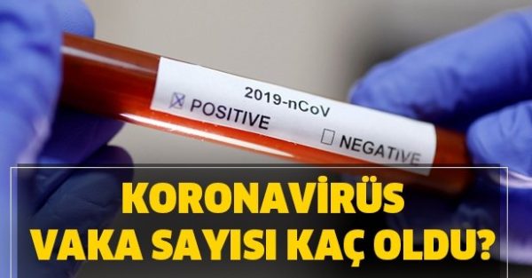 ZONGULDAK’TAKİ TOPLAM VAKA SAYISI…